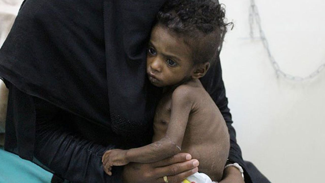 Yemen'de ilaç sıkıntısı devam ediyor