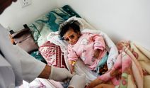 Savaşın sürdüğü Yemen'de beslenme krizi büyüyor