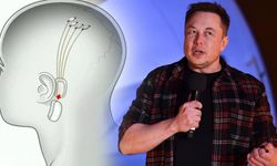 Elon Musk, insan beynine çip takmak için izin aldı