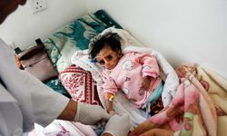 Savaşın sürdüğü Yemen'de beslenme krizi büyüyor