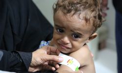 DSÖ'den Yemen'de artan kızamık ve çocuk felci vakalarına karşı uyarı